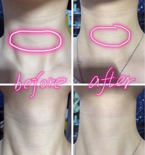 天鵝頸是什么樣的？天鵝頸怎么練？