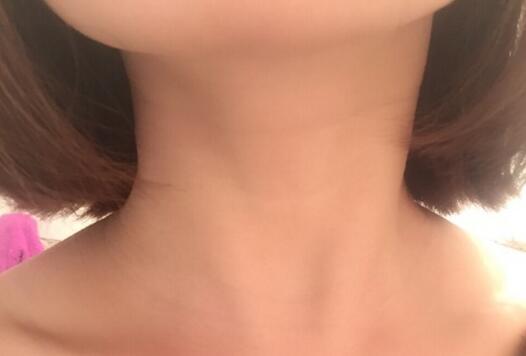 天鵝頸是什么樣的？天鵝頸怎么練？