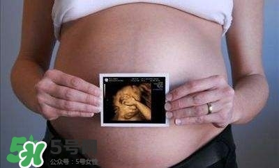 四維彩超能看出男女嗎？四維彩超能看清手指嗎？