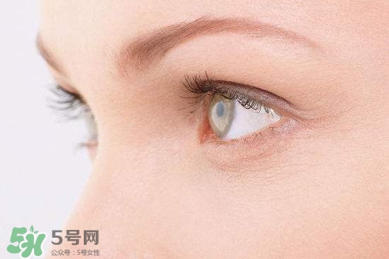 眼睛布滿血絲怎么回事？眼睛布滿血絲怎么辦