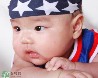 嬰兒被蚊子咬了如何去紅點(diǎn)？被蚊子咬后紅點(diǎn)如何去除？