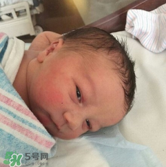 新生兒手握避孕環(huán)出生是怎么回事？出生后健康嗎？