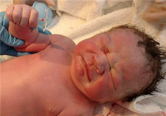 新生兒手握避孕環(huán)出生是怎么回事？出生后健康嗎？