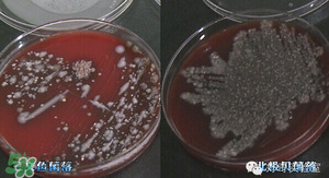 三文魚有刺嗎？三文魚的刺怎么處理