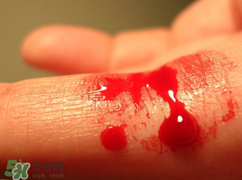 尸血會感染艾滋嗎？尸血可以治療血友病嗎？