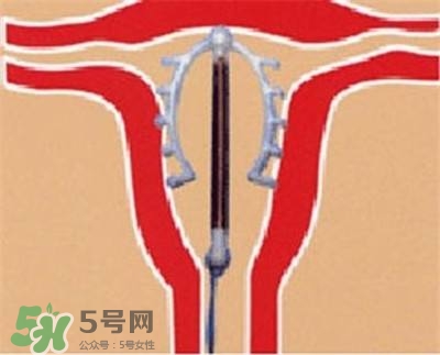 避孕環(huán)安全嗎？避孕環(huán)是什么樣子的圖片