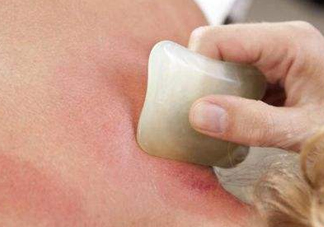 刮痧多久一次比較好？刮痧一次多長時間