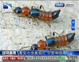 隱翅蟲(chóng)有毒嗎？隱翅蟲(chóng)會(huì)毀容嗎？