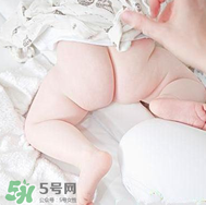 尿布疹和濕疹的區(qū)別 尿布疹和濕疹如何區(qū)分？