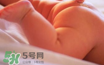 寶寶尿布疹可以擦紅霉素軟膏嗎？紅霉素軟膏對尿布疹有效嗎？