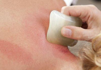 夏天刮痧好嗎？夏天拔罐好還是刮痧好？