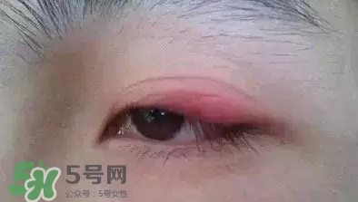 長(zhǎng)期用假睫毛雙眼皮貼對(duì)眼睛有什么傷害？