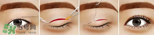 長(zhǎng)期用假睫毛雙眼皮貼對(duì)眼睛有什么傷害？