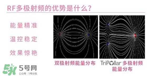 tripollar stop怎么樣？tripollar pose好用嗎
