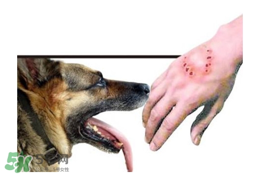 狂犬病會(huì)傳染嗎？狂犬病會(huì)學(xué)狗叫嗎