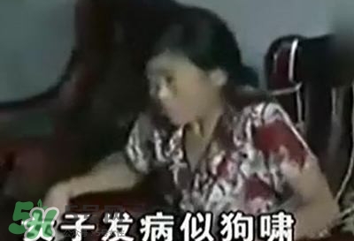 狂犬病能治好嗎？狂犬病的早期癥狀