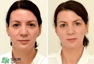 30天不喝飲料，妹子的對比照令人震驚 喝白開水的好處