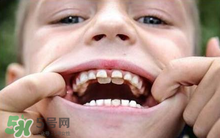 兒童換牙可以吃鈣片嗎?兒童換牙吃什么好？