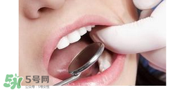 兒童換牙還沒掉就長牙正常嗎？兒童換牙先長牙是為什么？