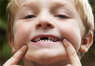 寶寶換牙可以吃糖嗎？小孩換牙期間能不能吃糖？