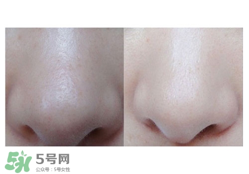 碧柔鼻貼白色和黑色哪個好？碧柔鼻貼黑白區(qū)別