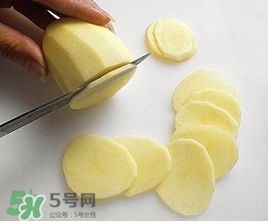 馬鈴薯能去痘印嗎？馬鈴薯可以祛痘??？