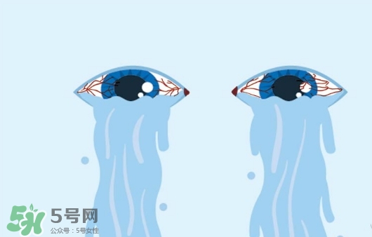 眼藥水可以兩個(gè)人用嗎？眼藥水可以共用嗎？