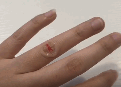 液體創(chuàng)可貼防水嗎？液體創(chuàng)可貼防水嗎透氣嗎？