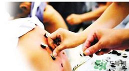 三伏貼要貼幾次？三伏貼要貼多久？