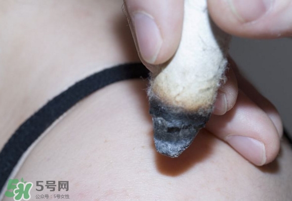 艾灸后為什么會癢？艾灸后為什么要多喝水