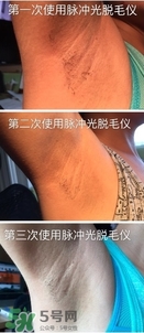 松下es wh93脫毛儀怎么樣？松下es wh93脫毛儀多少錢