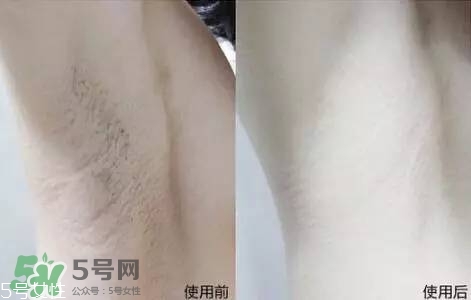 nair脫毛膏評(píng)測(cè)？nair脫毛膏保質(zhì)期