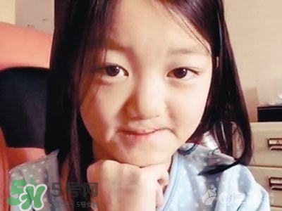 兔唇是什么？兔唇是什么原因造成的？