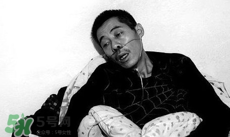 塵肺病能治愈嗎？塵肺病能活多久