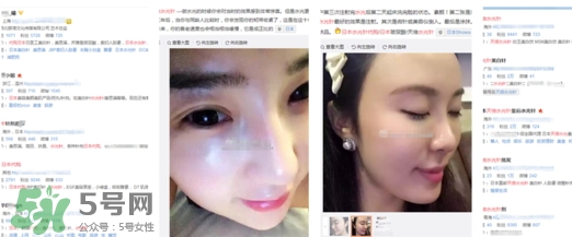 天倍面膜是日本的嗎？日本tenbe天倍面膜騙局