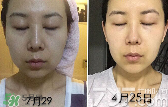 黃金棒有什么用？黃金棒的功效與作用