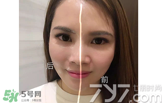 黃金棒有什么用？黃金棒的功效與作用