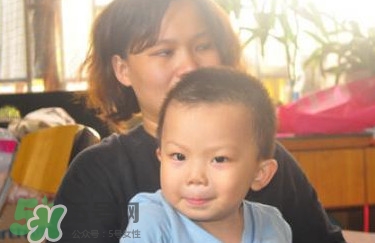 地中海貧血有什么癥狀？地中海貧血能活多久