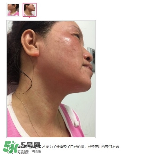 肌膚之食是什么牌子？肌膚之食讓我毀容了