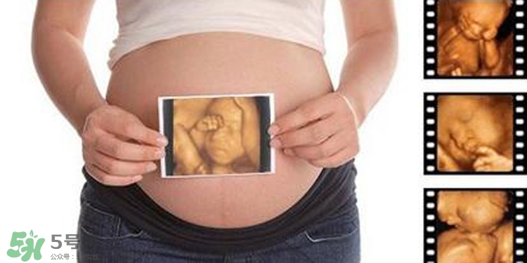 四維彩超有必要做嗎？四維彩超檢查不出什么？