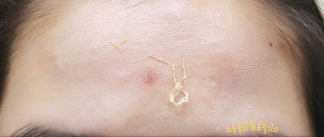 real skin patch怎么樣？real skin是什么牌子