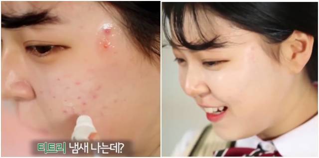 real skin patch怎么樣？real skin是什么牌子