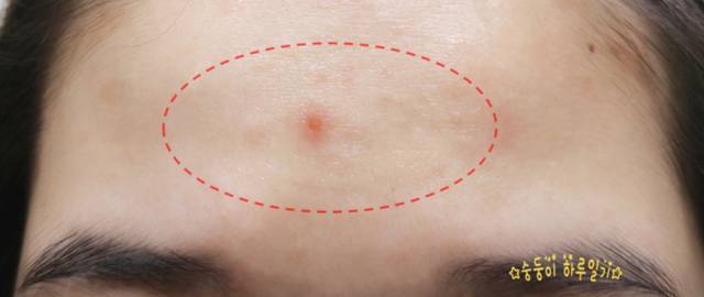 real skin patch怎么樣？real skin是什么牌子