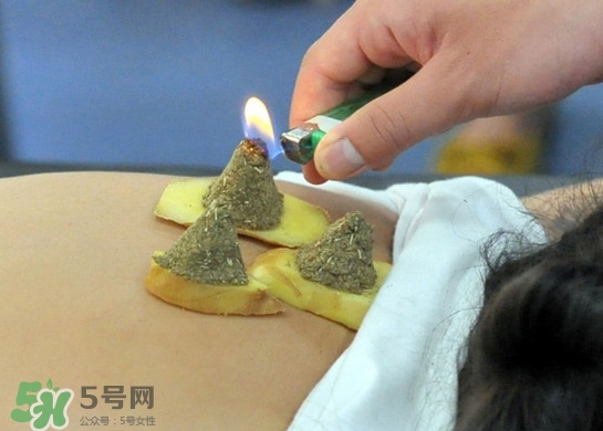 三伏灸灸哪里？三伏灸是每天都灸嗎