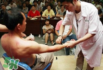 刮痧痛嗎？刮痧疼還是拔罐疼