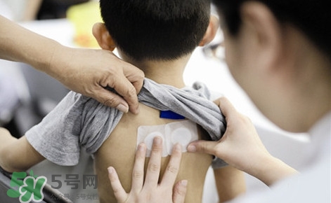 三伏灸有什么作用？三伏灸不能吃什么