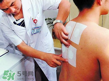 三伏灸可以治療什么??？三伏灸與艾灸有什么區(qū)別