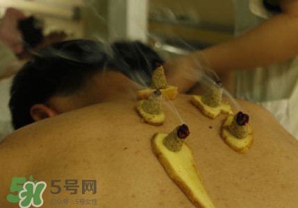 三伏灸有用嗎？2017年三伏艾灸時(shí)間