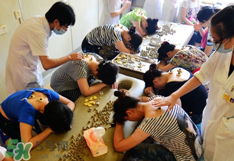 三伏灸有什么作用？三伏灸不能吃什么