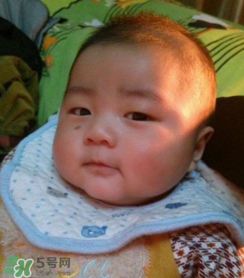 寶寶胎記什么時(shí)候去掉？寶寶胎記什么時(shí)候去掉最好？